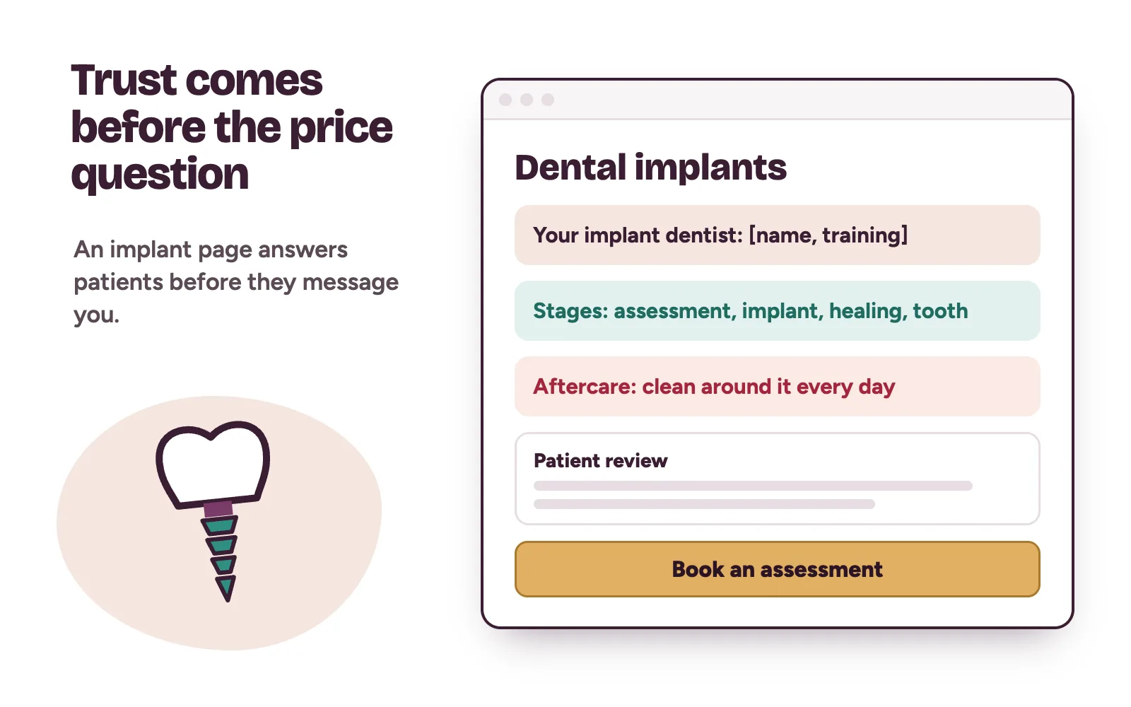 A dental clinic implant page with the dentist’s details, the treatment stages, aftercare notes and a book an assessment button