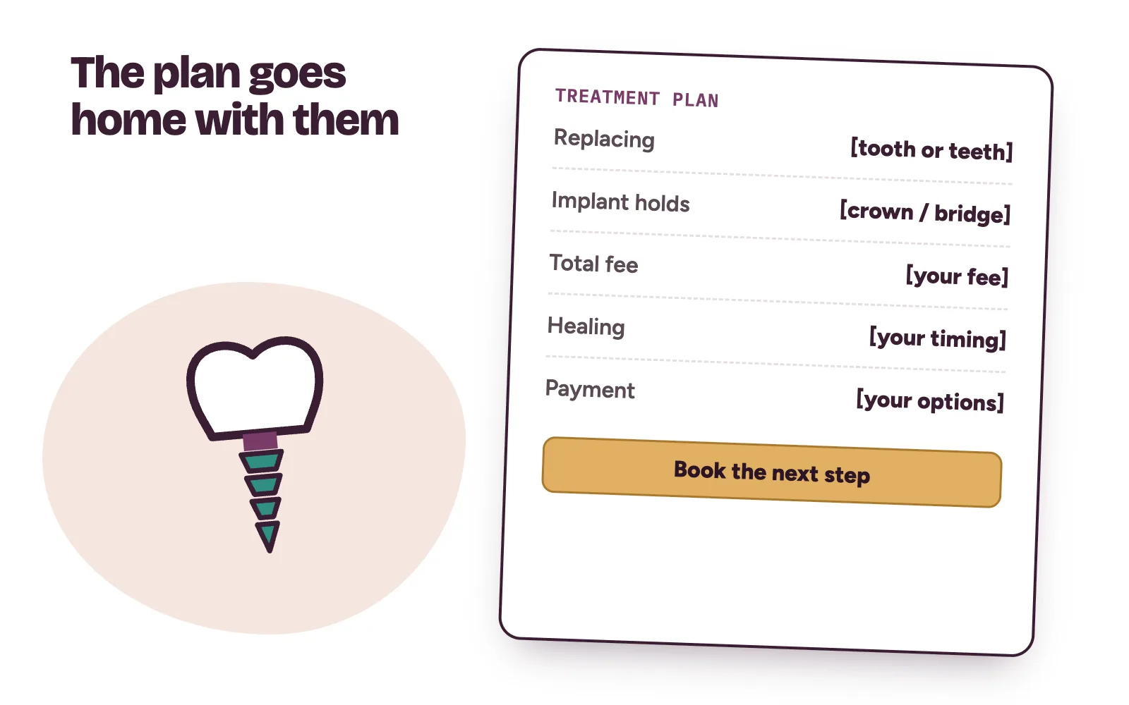 A written dental implant treatment plan card listing what is replaced, the total fee placeholder, the stages and payment options